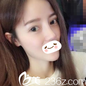 術(shù)后二十天恢復(fù)情況