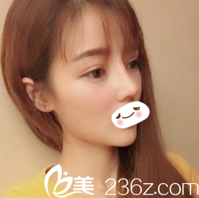 韓國(guó)時(shí)雨整形醫(yī)院鼻整形真人案例：從平凡少女到小仙女的距離就差一個(gè)鼻綜合