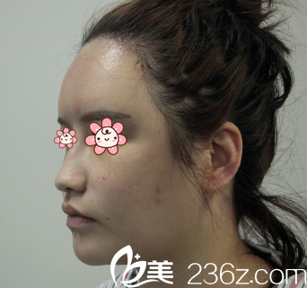 姬廣翰醫(yī)生給我手術(shù)當(dāng)天