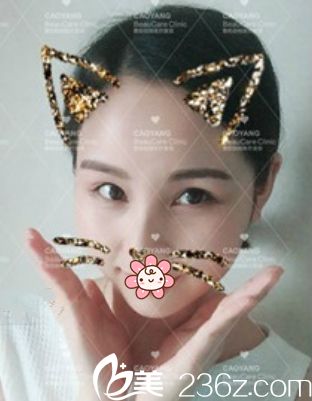 沒眼袋了就是好看