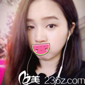 術(shù)前照片 術(shù)前照片