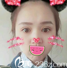 術(shù)后一周拆線 術(shù)后一周拆線