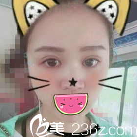 半個(gè)月恢復(fù)情況 半個(gè)月恢復(fù)情況