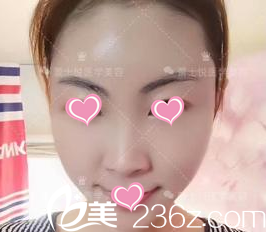 兩個月的照片 兩個月的照片