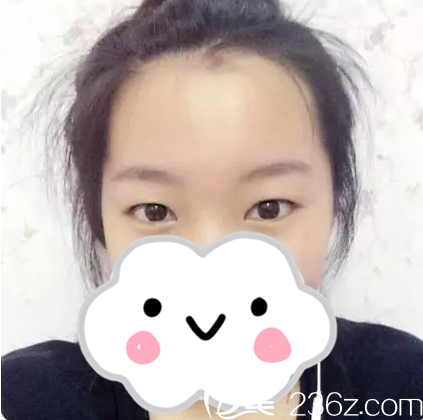 手術(shù)前的我 手術(shù)前的我