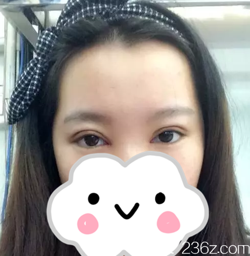 術(shù)后四天 術(shù)后四天