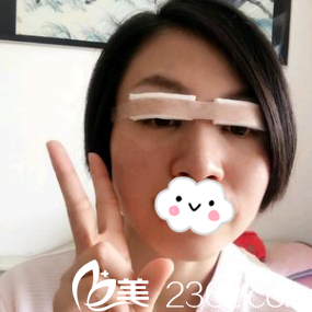 術(shù)后當(dāng)天即刻效果