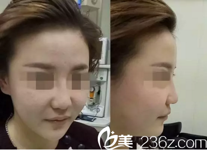 手術(shù)前的我 手術(shù)前的我