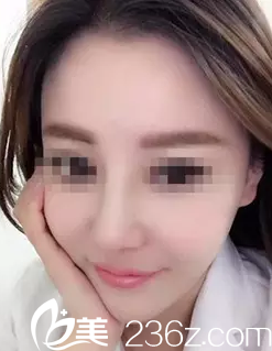 術(shù)后半個月 術(shù)后半個月