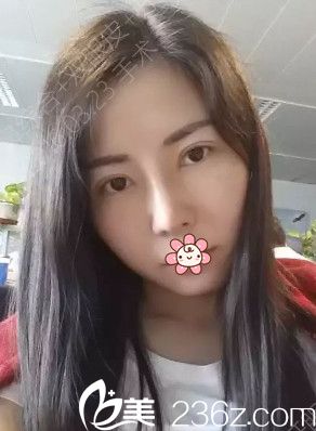 工作忙，憔悴啊