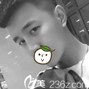 贛州亞韓吳禮誠雙眼皮手術案例 贛州亞韓吳禮誠雙眼皮手術案例