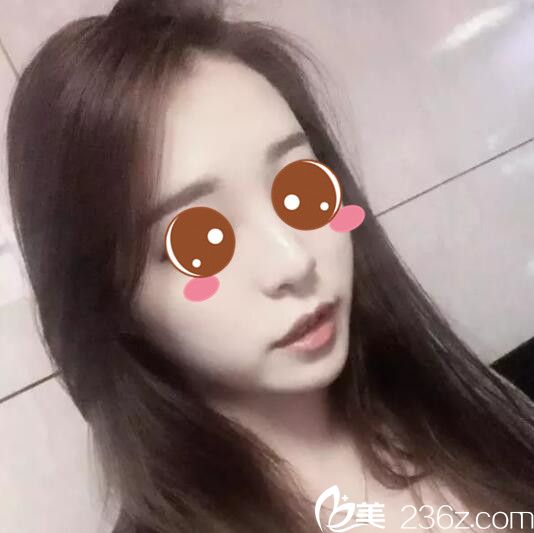 韓國BE&ME樸晉弘韓式半紋眉真人案例術(shù)后第三天 韓國BE&ME樸晉弘韓式半紋眉真人案例術(shù)后第三天