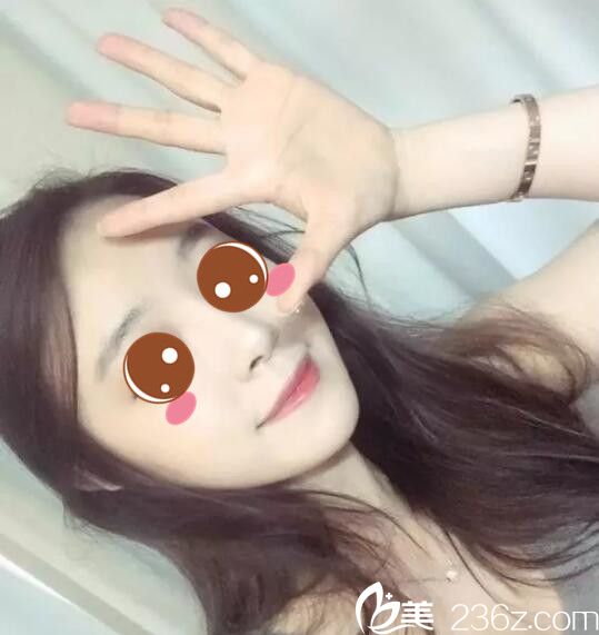 韓國BE&ME樸晉弘韓式半紋眉真人案例術(shù)后第七天 韓國BE&ME樸晉弘韓式半紋眉真人案例術(shù)后第七天