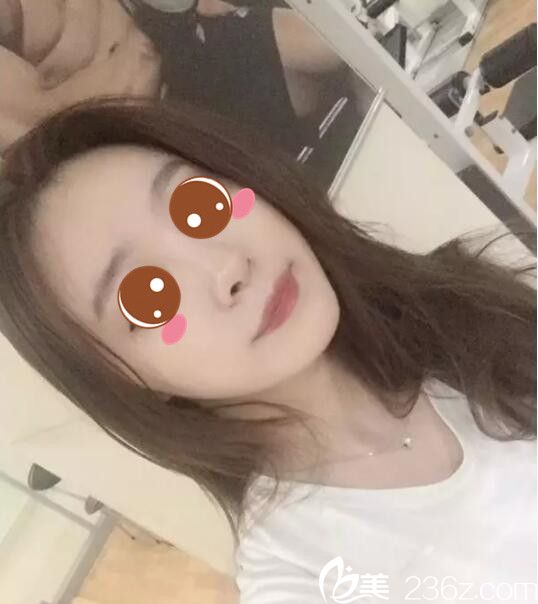 韓國BE&ME樸晉弘韓式半紋眉真人案例術(shù)后一個(gè)月 韓國BE&ME樸晉弘韓式半紋眉真人案例術(shù)后一個(gè)月