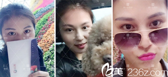 現(xiàn)在完全消腫了，但是還有些增生在恢復(fù)