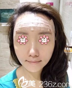 王世宏醫(yī)生給我做完手術(shù)第二天 王世宏醫(yī)生給我做完手術(shù)第二天