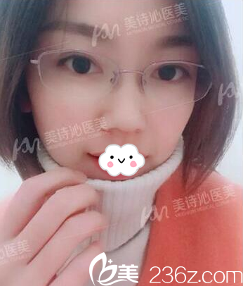 我來公開之前去廣州美詩沁找馬滿倉做20分鐘不開刀去眼袋的親身經(jīng)歷