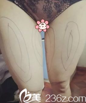 去重慶美侖美奐整形醫(yī)院面診 去重慶美侖美奐整形醫(yī)院面診