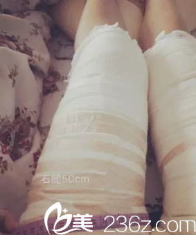 腿瘦了3厘米 腿瘦了3厘米