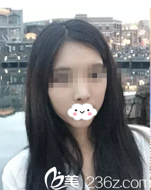 手術(shù)前的我 手術(shù)前的我