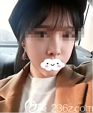 株洲華美改變了我的面部不對稱，讓我的美麗無可挑剔