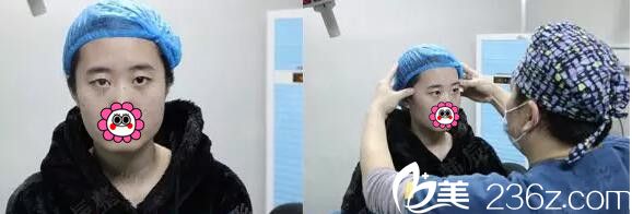 術(shù)前眼部的面診和咨詢 術(shù)前眼部的面診和咨詢