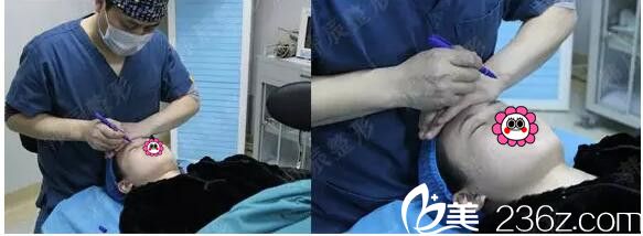 王文醫(yī)生雙眼皮手術(shù)中 王文醫(yī)生雙眼皮手術(shù)中