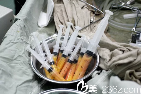 手術(shù)中先抽取脂肪 手術(shù)中先抽取脂肪