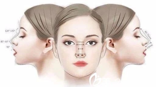 長(zhǎng)春長(zhǎng)青麗人隆鼻多少錢？鼻綜合手術(shù)18900元起就能擁有