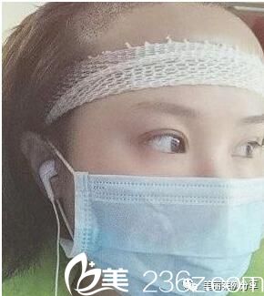 移植后兩天效果 移植后兩天效果