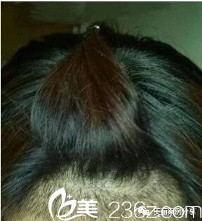 種植后一個(gè)月效果 種植后一個(gè)月效果