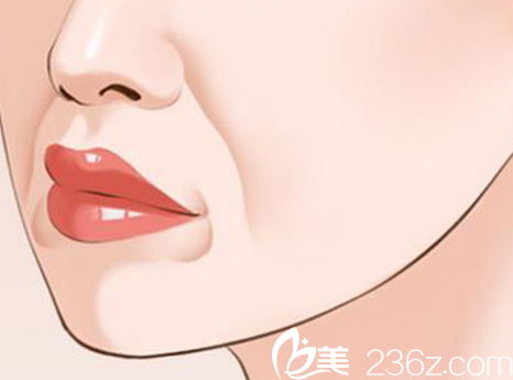 面部有法令紋老十歲？南寧農(nóng)霖自體脂肪祛除法令紋9980元起幫你去除