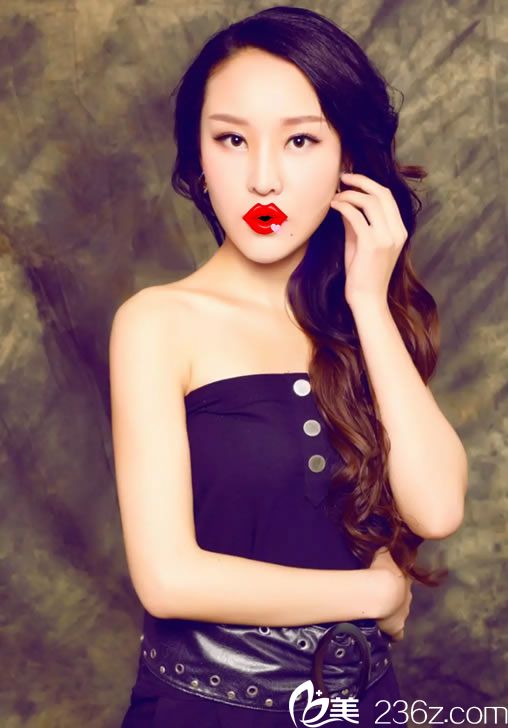 我叫吳玲，給大家講講在紹興維美做雙眼皮+隆鼻+豐下巴+瘦臉+祛斑系列手術(shù)歷程