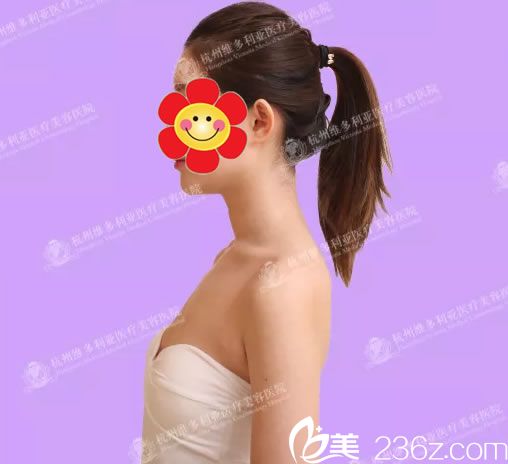 做自體脂肪隆胸前的平胸照 做自體脂肪隆胸前的平胸照