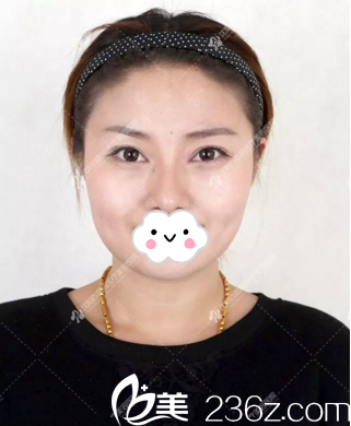 術(shù)后20天恢復(fù)情況 術(shù)后20天恢復(fù)情況