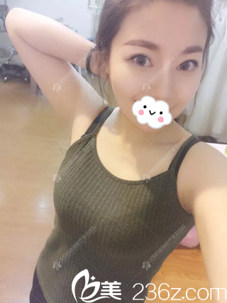 鼻綜合半年后效果 鼻綜合半年后效果