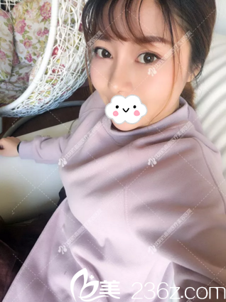 鼻綜合術(shù)1年恢復(fù)情況 鼻綜合術(shù)1年恢復(fù)情況