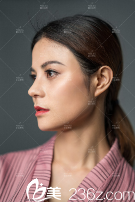 單磊醫(yī)生生態(tài)美鼻案例