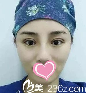 馬晶醫(yī)生隆鼻手術(shù)案例