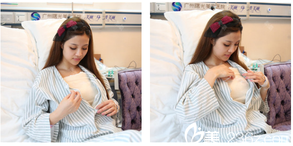 廣州曙光劉杰偉隆胸術(shù)后7天恢復(fù)情況