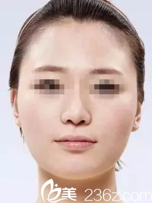 柳州仁美自體脂肪填充術(shù)前 柳州仁美自體脂肪填充術(shù)前