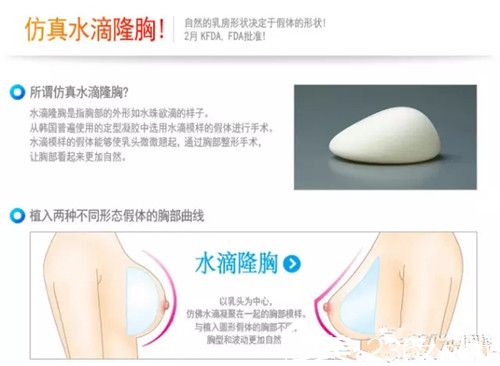 自體脂肪隆胸 自體脂肪隆胸