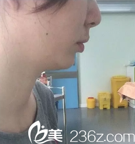 西安高一生醫(yī)院高秀梅做光纖溶脂面部的<span style= 西安高一生醫(yī)院高秀梅做光纖溶脂面部的<span style=