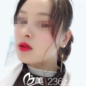 術(shù)后20天