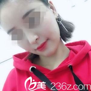 術(shù)后一個月