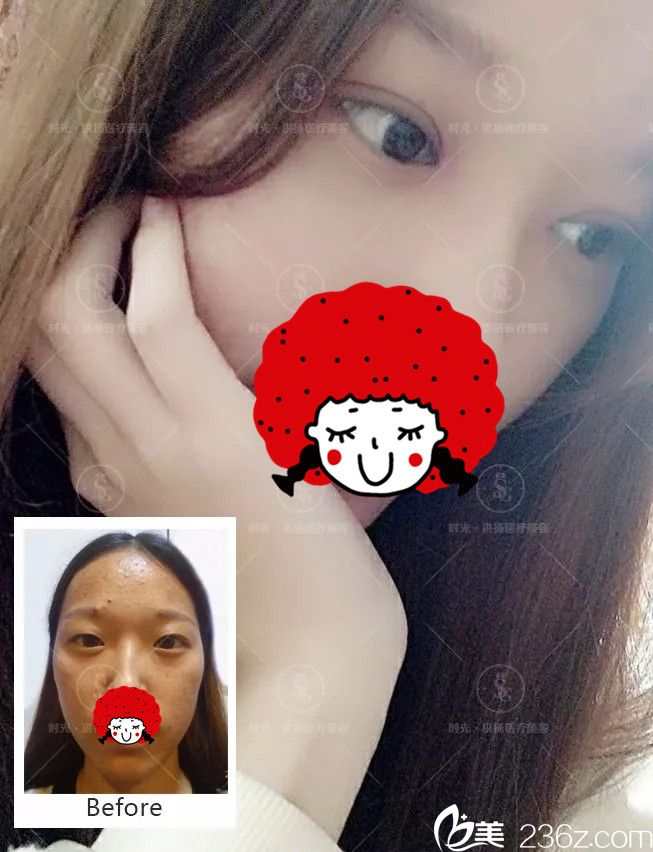 徐州時光洪揚(yáng)術(shù)前術(shù)后蛻變 徐州時光洪揚(yáng)術(shù)前術(shù)后蛻變