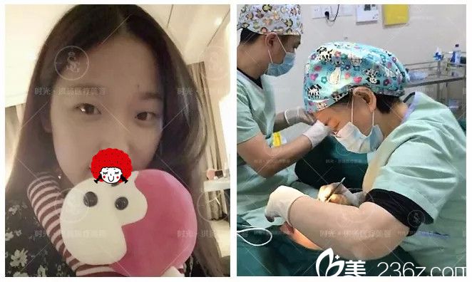 眼綜合激光美膚整形手術(shù)過程中 眼綜合激光美膚整形手術(shù)過程中