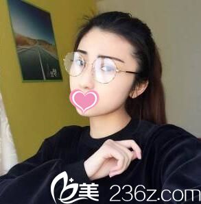 雙眼皮一周拆線