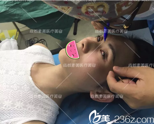 <!--<i data=20240703-sp></i>-->楊迪雙眼皮術(shù)前設(shè)計 <!--<i data=20240703-sp></i>-->楊迪雙眼皮術(shù)前設(shè)計