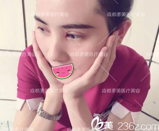 <!--<i data=20240703-sp></i>-->雙眼皮拆線后效果 <!--<i data=20240703-sp></i>-->雙眼皮拆線后效果